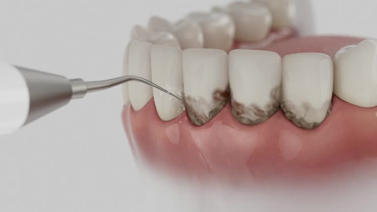 Reliable Dental Implants contractor in Shell Lake, WI by Smile Center Dentistry